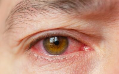 glaucome par fermeture de l angle
