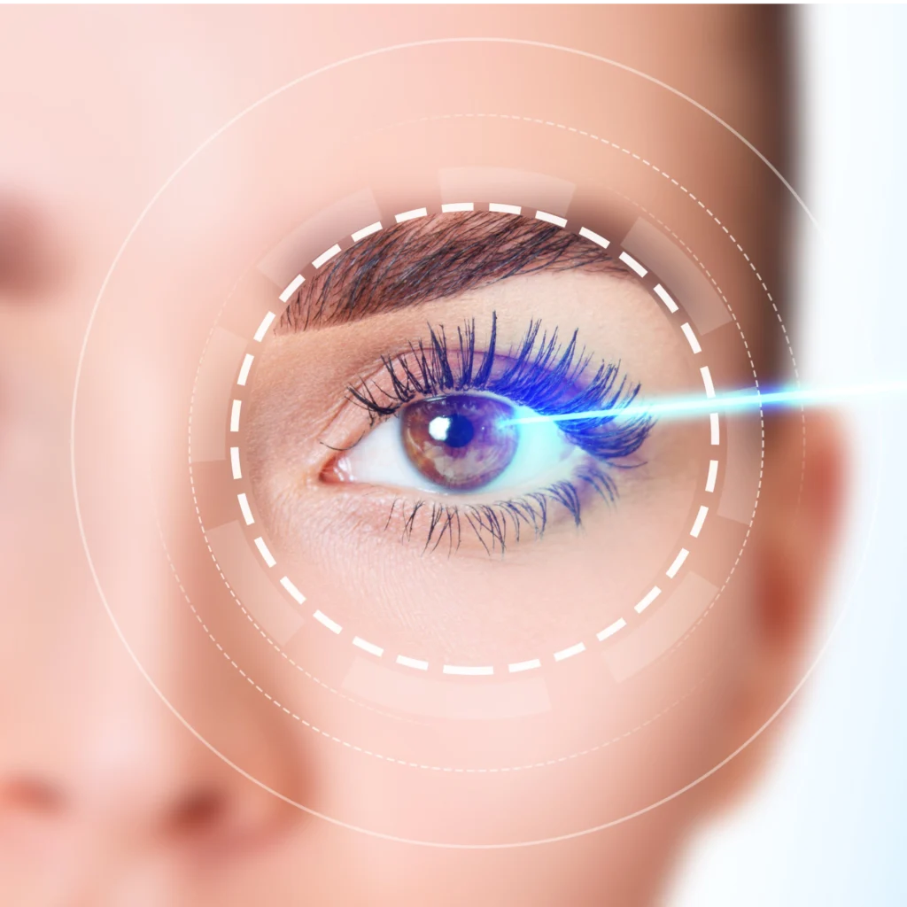 La Correction de la vision au laser Casablanca scaled